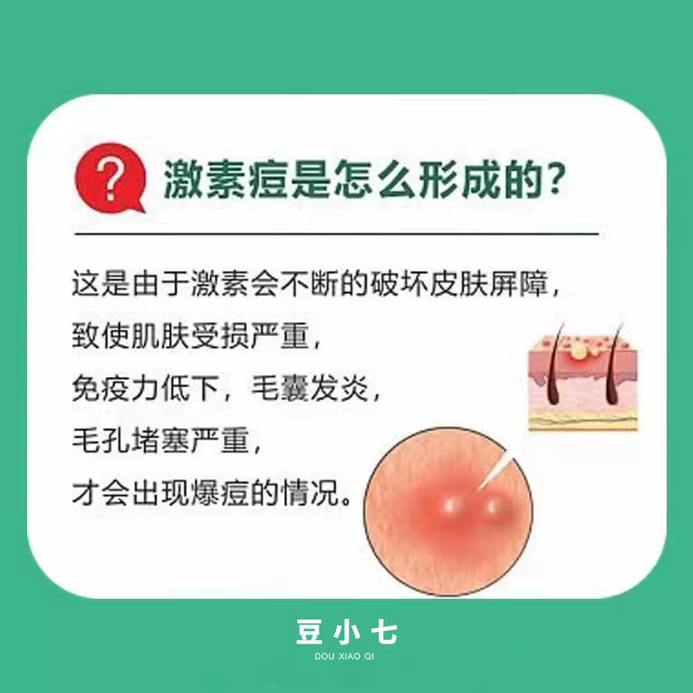 什么是激素痘？激素痘該如何調理？